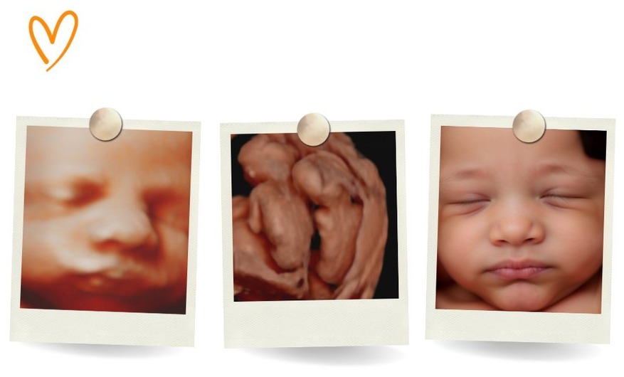 Família a acompanhar uma sessão de imagem digital pré-natal